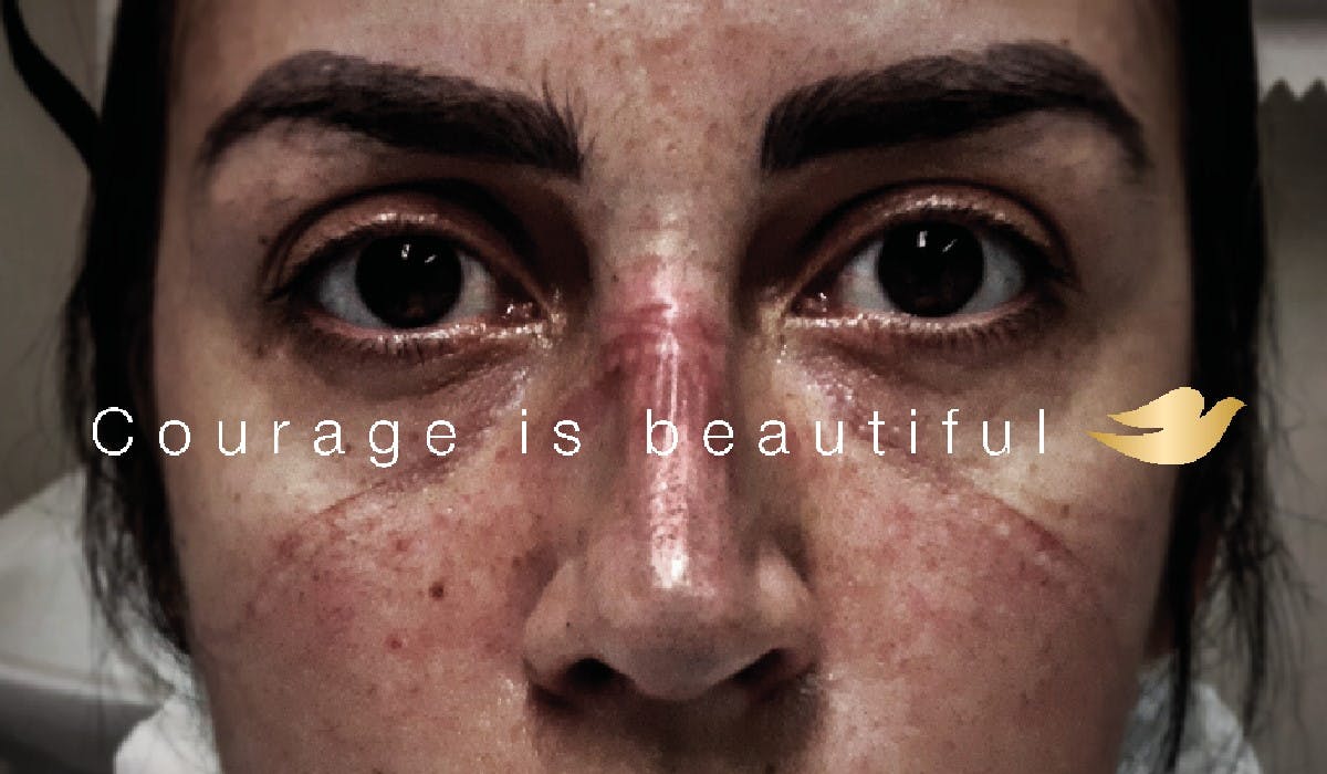 doves campaign for real beauty case study analysis